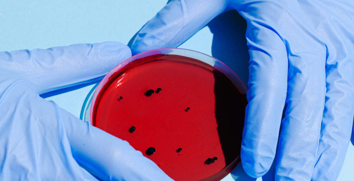 person-holding-petri-dish-3786217
